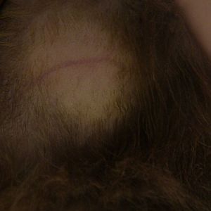 Cat going bald on feet,  with ear problems, with pictures, please help.