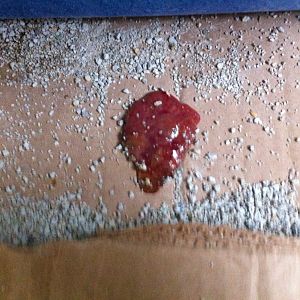Red jelly like substance in poop