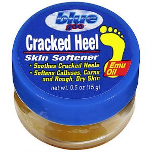 Cream for Cracked Knuckles?