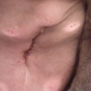 My Cat's Incision
