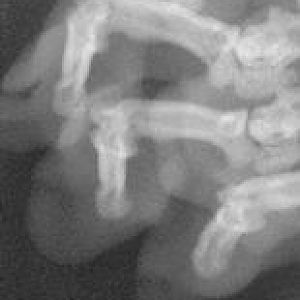 x-ray, declawed 3.jpg