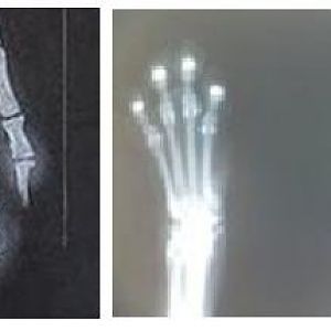 x-ray, healthy vs declawed.JPG