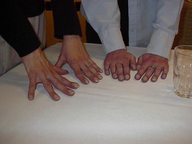 Ph's & Kim's hands.jpg
