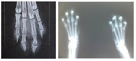 x-ray, healthy vs declawed.JPG